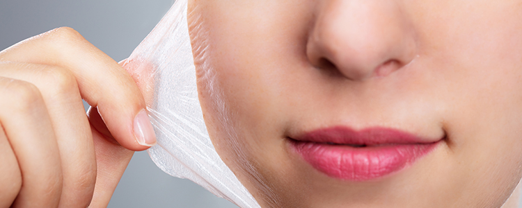 How to Get Rid of Peeling Skin on the Face